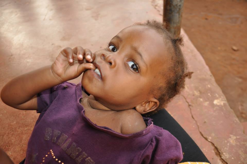 Though she appears to be an infant, Destiny is almost 3. She just started walking but has a rash that covers her entire neck and crotch. The caramel-colored hair is a sign of advanced malnourishment.