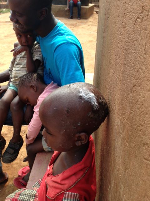 More than one head looked like this and ringworm was present on almost every child at GGO